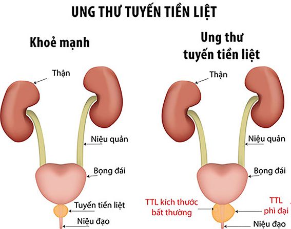 https://benhvienk.vn/data/media/1601/images/sk-1292--2-.jpg