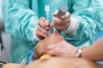 Lựa chọn phương pháp gây mê hay gây tê trong phẫu thuật tuyến giáp